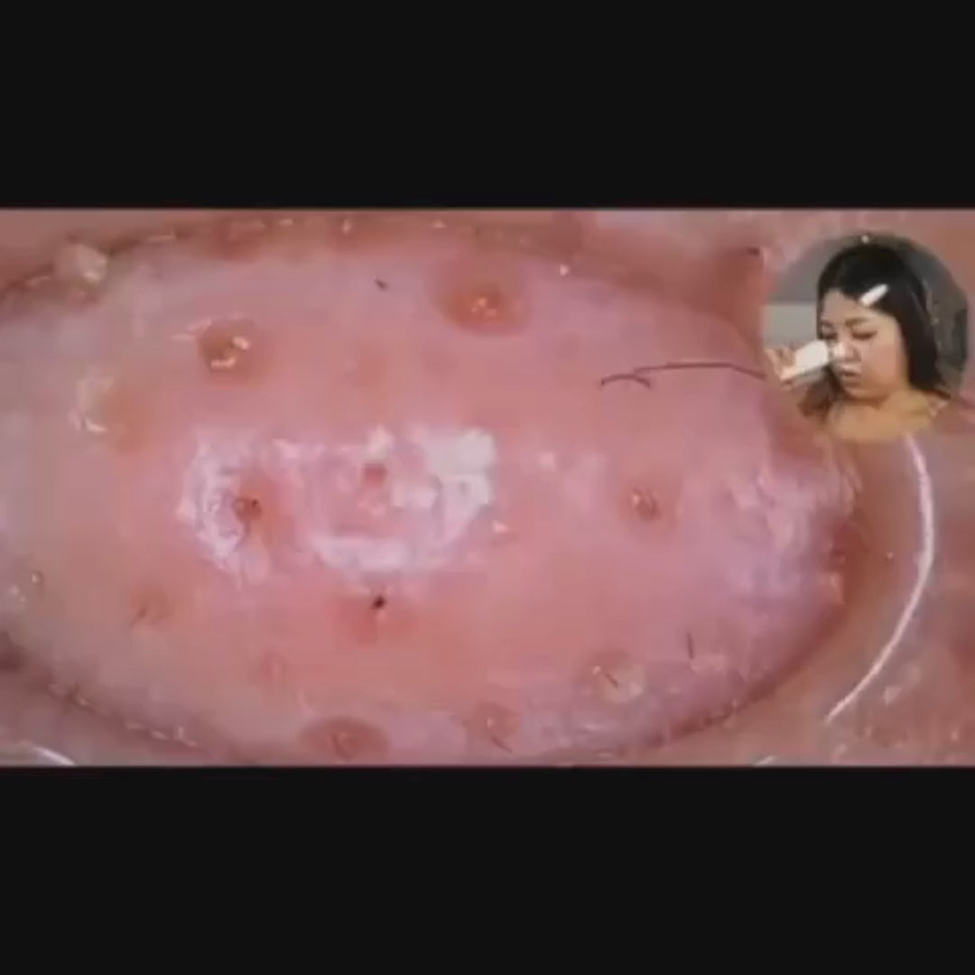Cargar video: 